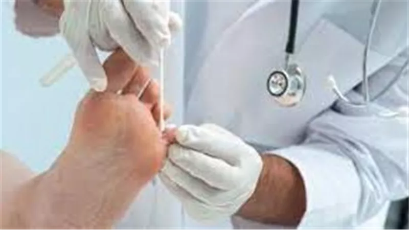 طرق عدوى مرض قدم